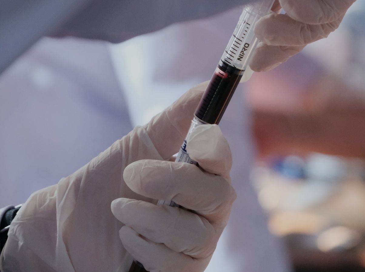 Gloved hands drawing blood into a syringe for regenerative therapy preparation